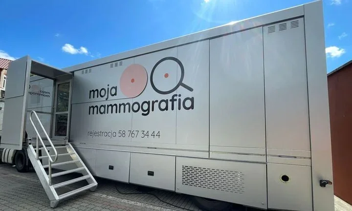 Mammobus przyjedzie do Sosnowca. Badanie trwa chwilę i może uratować życie